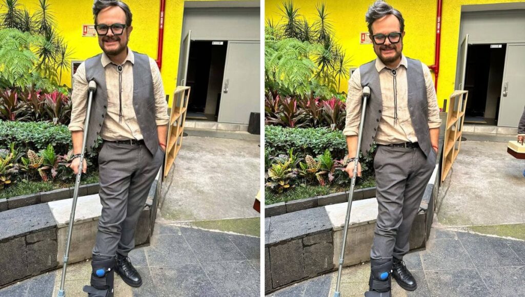 Alex Syntek aparece con bota ortopédica tras caída